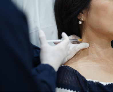 Treatment collagen stimulator di Kontura